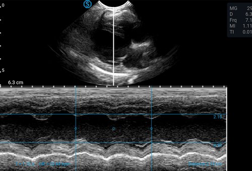 SIUI VP2 Ultraschallbild: Herz