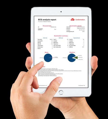 Cardiomatics Auswertung auf dem Tablet