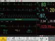 iM50 - Multi-Parameter-Patientenmonitor