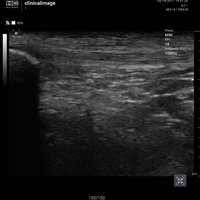 thumb: Convex 300C S/W