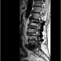 thumb: OASIS™ 1,2T