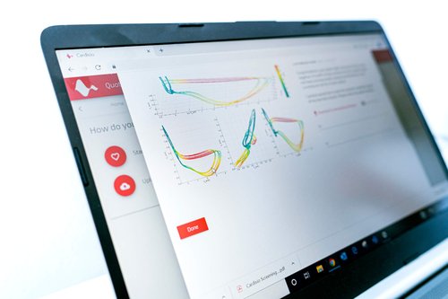Auswertung Cardisiographie