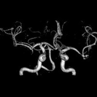 thumb: APERTO Lucent Plus