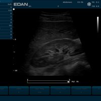 thumb: U2 Prime Edition