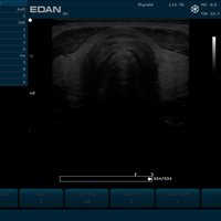 thumb: U2 Vet Prime Edition