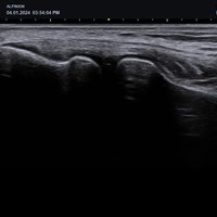 thumb: X-CUBE 50