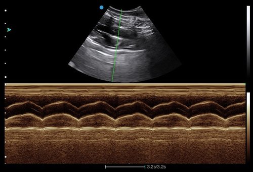 Ultraschalluntersuchung mit dem Apogee 1000V Lite