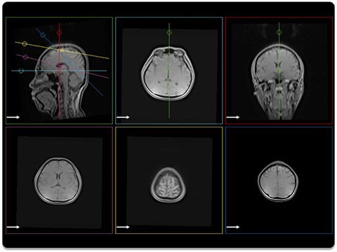 EasyTech NeuroLine