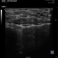 thumb: Convex 300C S/W