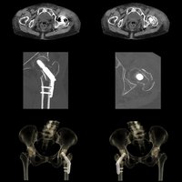 thumb: Bildgebung mit dem Aquilion One PRISM Edition