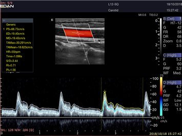 Ultraschalldiagnostik mit dem Acclarix LX9
