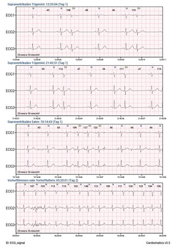 Cardiomatics Report Beispiel 7