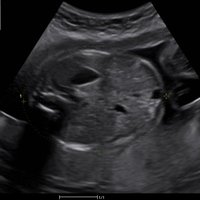 thumb: Bildgebung mit dem Apogee 6300