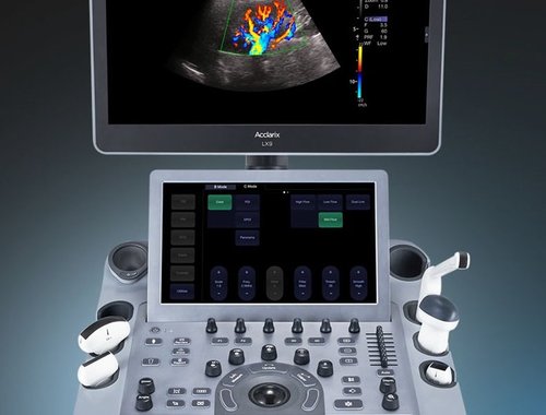 Bedienfeld des Acclarix LX9