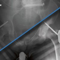 thumb: Beispiel für Anwendung der Scatter Correction Software