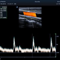 thumb: E-CUBE 8 Diamond