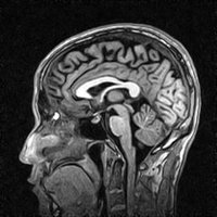 thumb: APERTO Lucent Plus