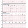 thumb: Cardiomatics Report Beispiel 4