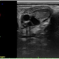 thumb: iScan II mit linearem Rektalkopf (iS II L)