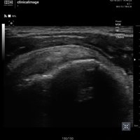 thumb: Convex 300C S/W