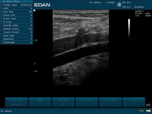 Vene, Arterie