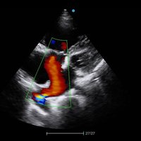 thumb: Farbdoppler mit dem Apogee 1000 Neo