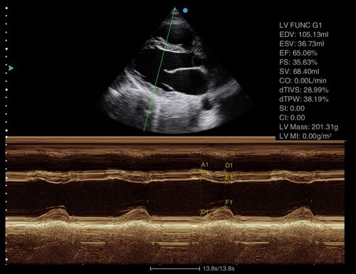 Ultraschalluntersuchung mit dem Apogee 5300