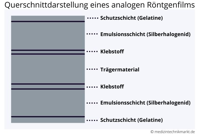 Querschnittdarstellung: analoger Röntgenfilm Querschnittdarstellung: analoger Röntgenfilm