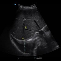 thumb: Bildgebung mit dem Apogee 1000 Neo