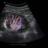 thumb: Bildgebung mit dem Apogee 2300