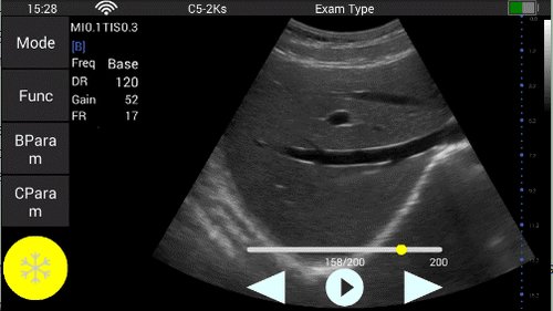 Abdominalscan mit dem Youkey QSONO D8