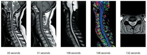 Easy Spine Protocol