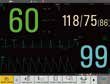 iM50 - Multi-Parameter-Patientenmonitor