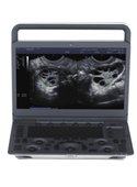 Ultraschall SonoScape E1