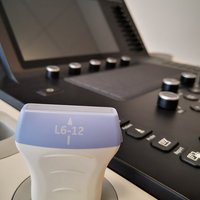 thumb: GE Versana Premier Black Bedienoberfläche und Sonde