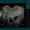 thumb: Uterus, sagittal