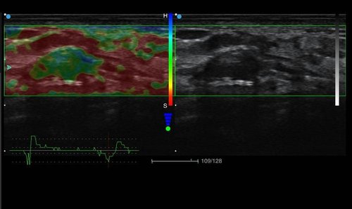 Diagnostik mit dem Apogee 5300