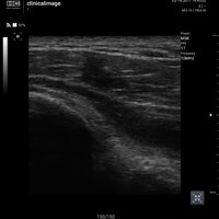 thumb: Convex 300C S/W