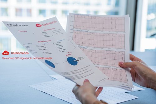 Cardiomatics Auswertung in gedruckter Form