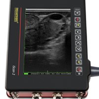 thumb: iScan II mit linearem Rektalkopf (iS II L)