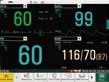 iM50 - Multi-Parameter-Patientenmonitor