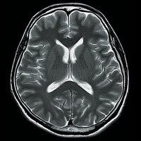 thumb: Easy Brain Protocol T2 30 Sek.