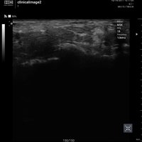 thumb: Convex 300C S/W