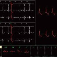 thumb: SE-2003/2012 | SE-2003A/2012A