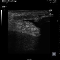 thumb: Convex 300C S/W