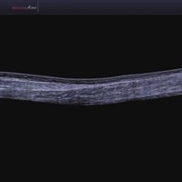 thumb: Panoramablick