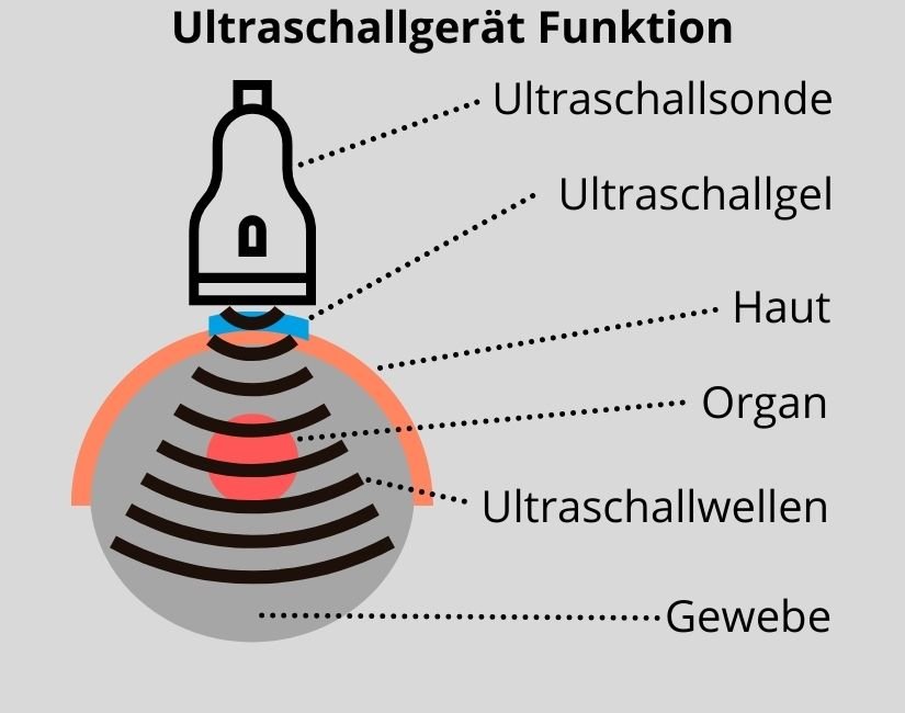 Wie funktioniert eine Ultraschalluntersuchung?