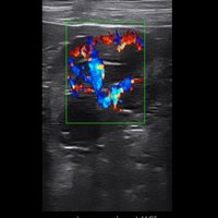 thumb: Bildgebung im Farbdopplermodus mit dem Apogee 1000V Lite