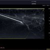 thumb: Ultraschall Nadelführung mit dem Acclarix LX9