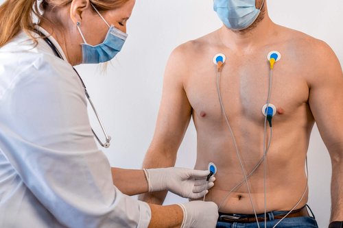 Verbindung der Elektroden bei der Cardisiographie